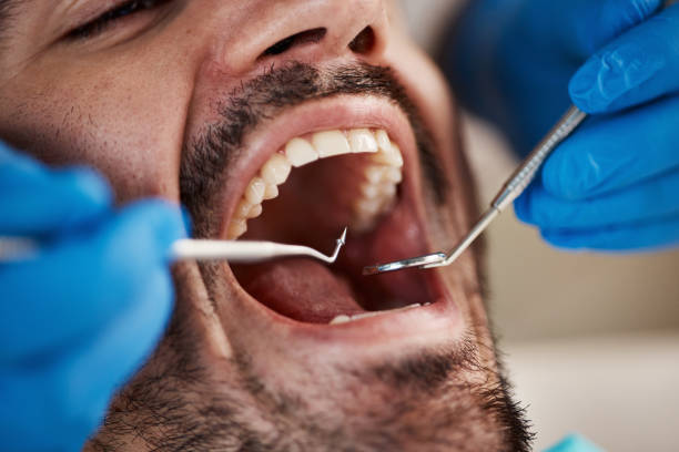 Best Walk-In Emergency Dentist in Lincoln Beach, OR